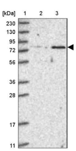 ZNF526 Antibody, Novus Biologicals:Antibodies:Primary Antibodies