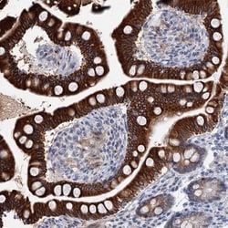 ZNF527 Antibody, Novus Biologicals 0.1mL; Unlabeled:Antibodies, Polyclonal