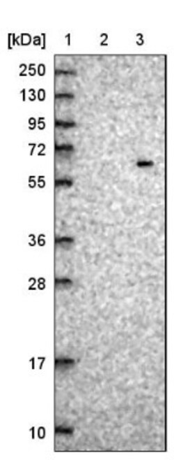 ZNF529 Antibody, Novus Biologicals 0.1mL; Unlabeled:Antibodies, Polyclonal