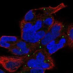 ZNF530 Antibody, Novus Biologicals 0.1mL; Unlabeled:Antibodies, Polyclonal