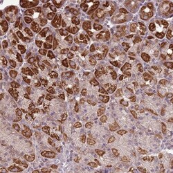 ZNF530 Antibody, Novus Biologicals 0.1mL; Unlabeled:Antibodies, Polyclonal
