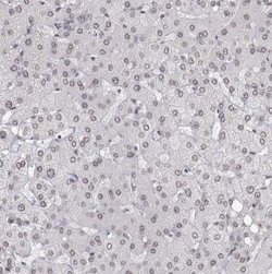 ZNF532 Antibody, Novus Biologicals 25 &mu;L; Unlabeled:Antibodies, Polyclonal