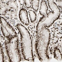 ZNF537 Antibody, Novus Biologicals 25 &mu;L, Unlabeled:Antibodies, Polyclonal
