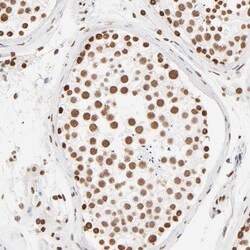 ZNF540 Antibody, Novus Biologicals 0.1mL; Unlabeled:Antibodies, Polyclonal