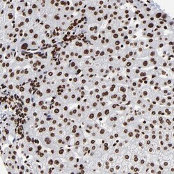 ZNF544 Antibody, Novus Biologicals 25 &mu;L; Unlabeled:Antibodies, Polyclonal