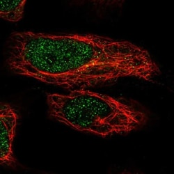 ZNF548 Antibody, Novus Biologicals 25 &mu;L, Unlabeled:Antibodies, Polyclonal