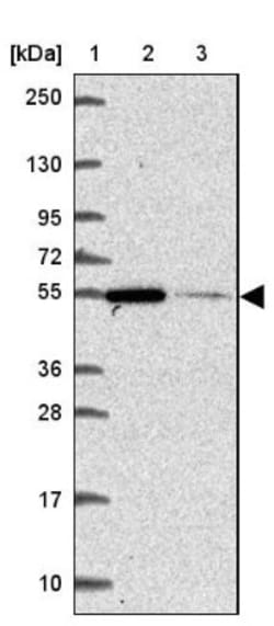 ZNF548 Antibody, Novus Biologicals 25 &mu;L, Unlabeled:Antibodies, Polyclonal