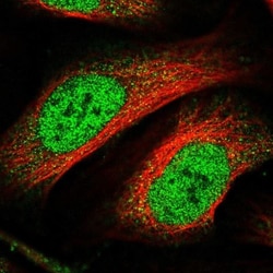 ZNF549 Antibody, Novus Biologicals:Antibodies:Primary Antibodies