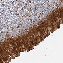 ZNF549 Antibody, Novus Biologicals:Antibodies:Primary Antibodies