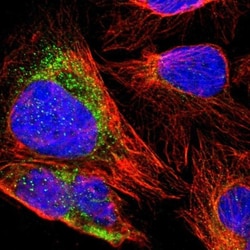 ZNF550 Antibody, Novus Biologicals 25 &mu;L; Unlabeled:Antibodies, Polyclonal