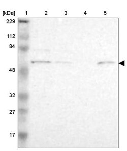 ZNF550 Antibody, Novus Biologicals 25 &mu;L; Unlabeled:Antibodies, Polyclonal