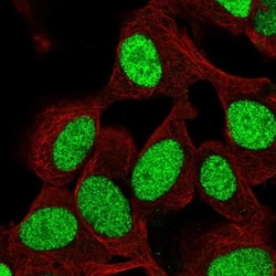 ZNF554 Antibody, Novus Biologicals 25 &mu;L, Unlabeled:Antibodies, Polyclonal