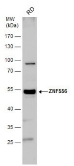 ZNF556 Antibody, Novus Biologicals 0.1mL:Antibodies, Polyclonal