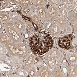 ZNF557 Antibody, Novus Biologicals:Antibodies:Primary Antibodies