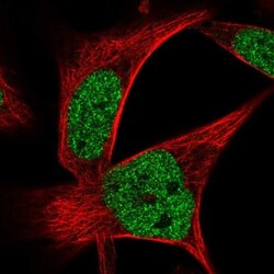 ZNF559 Antibody, Novus Biologicals:Antibodies:Primary Antibodies