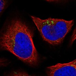 ZNF564 Antibody, Novus Biologicals 0.1mL; Unlabeled:Antibodies, Polyclonal