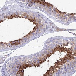 ZNF564 Antibody, Novus Biologicals 0.1mL; Unlabeled:Antibodies, Polyclonal