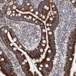 ZNF566 Antibody, Novus Biologicals:Antibodies:Primary Antibodies