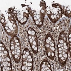ZNF570 Antibody, Novus Biologicals:Antibodies:Primary Antibodies
