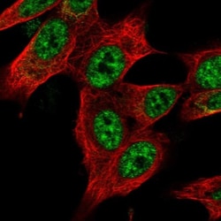 ZNF572 Antibody, Novus Biologicals 25 &mu;L, Unlabeled:Antibodies, Polyclonal