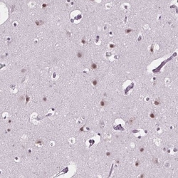 ZNF572 Antibody, Novus Biologicals 25 &mu;L, Unlabeled:Antibodies, Polyclonal
