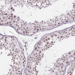 ZNF572 Antibody, Novus Biologicals 25 &mu;L, Unlabeled:Antibodies, Polyclonal