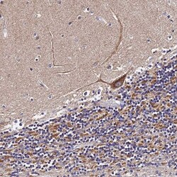 ZNF573 Antibody, Novus Biologicals 0.1mL; Unlabeled:Antibodies, Polyclonal