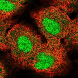 ZNF575 Antibody, Novus Biologicals 0.1mL; Unlabeled:Antibodies, Polyclonal