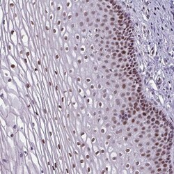 ZNF575 Antibody, Novus Biologicals 0.1mL; Unlabeled:Antibodies, Polyclonal