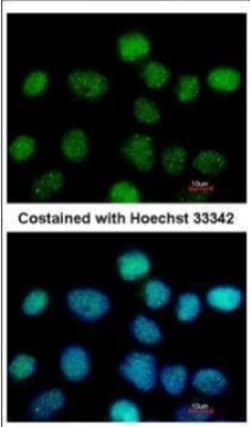 ZNF597 Antibody, Novus Biologicals 0.1mL; Unlabeled:Antibodies, Polyclonal