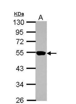 ZNF597 Antibody, Novus Biologicals 0.1mL; Unlabeled:Antibodies, Polyclonal