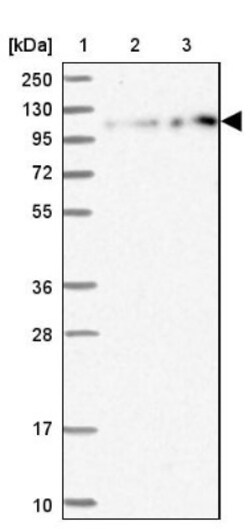 ZNF598 Antibody, Novus Biologicals 25 &mu;L; Unlabeled:Antibodies, Polyclonal