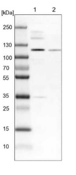 ZNF598 Antibody, Novus Biologicals 25 &mu;L; Unlabeled:Antibodies, Polyclonal