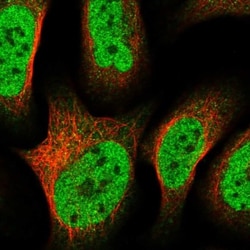 ZNF609 Antibody, Novus Biologicals 0.1mL; Unlabeled:Antibodies, Polyclonal