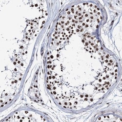 ZNF609 Antibody, Novus Biologicals 25 &mu;L, Unlabeled:Antibodies, Polyclonal