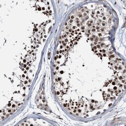 ZNF609 Antibody, Novus Biologicals 0.1mL; Unlabeled:Antibodies, Polyclonal