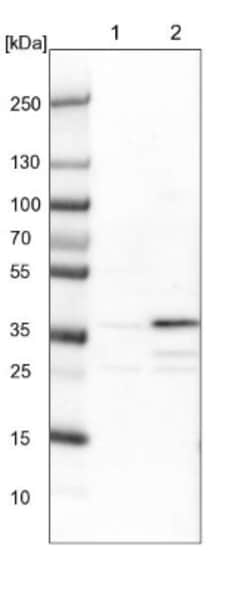 ZNF609 Antibody, Novus Biologicals 0.1mL; Unlabeled:Antibodies, Polyclonal