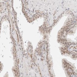 ZNF613 Antibody, Novus Biologicals:Antibodies:Primary Antibodies