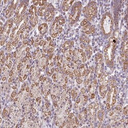 ZNF615 Antibody, Novus Biologicals 0.1mL; Unlabeled:Antibodies, Polyclonal
