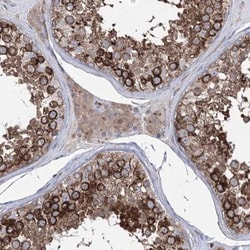 ZNF622 Antibody, Novus Biologicals 0.1mL; Unlabeled:Antibodies, Polyclonal