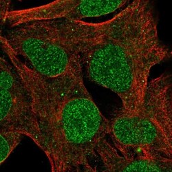 ZNF626 Antibody, Novus Biologicals:Antibodies:Primary Antibodies