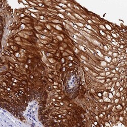 ZNF628 Antibody, Novus Biologicals 25 &mu;L, Unlabeled:Antibodies, Polyclonal