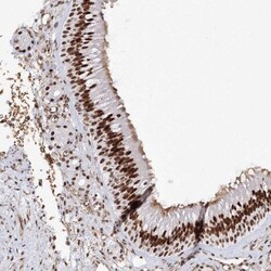 ZNF638 Antibody, Novus Biologicals 25 &mu;L; Unlabeled:Antibodies, Polyclonal