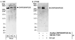 ZNF638 Antibody, Novus Biologicals 0.1 mL | Buy Online | Novus Biologicals | Fisher Scientific