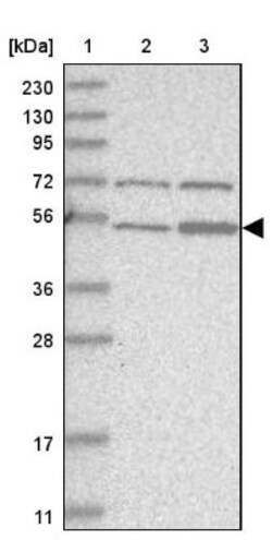 ZNF642 Antibody, Novus Biologicals:Antibodies:Primary Antibodies