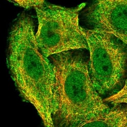 ZNF646 Antibody, Novus Biologicals 0.1mL; Unlabeled:Antibodies, Polyclonal