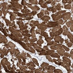 ZNF654 Antibody, Novus Biologicals:Antibodies:Primary Antibodies