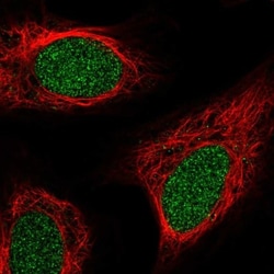 ZNF658 Antibody, Novus Biologicals:Antibodies:Primary Antibodies