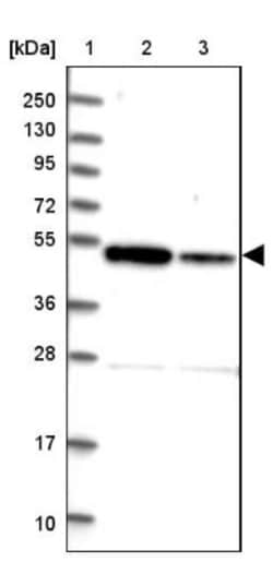 ZNF662 Antibody, Novus Biologicals 25 &mu;L | Buy Online | Novus Biologicals | Fisher Scientific