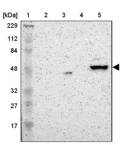 ZNF670 Antibody, Novus Biologicals 25 &mu;L; Unlabeled:Antibodies, Polyclonal